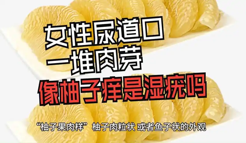 [尖锐湿疣科普]女性尿道口一堆肉芽像柚子痒是尖锐湿疣吗